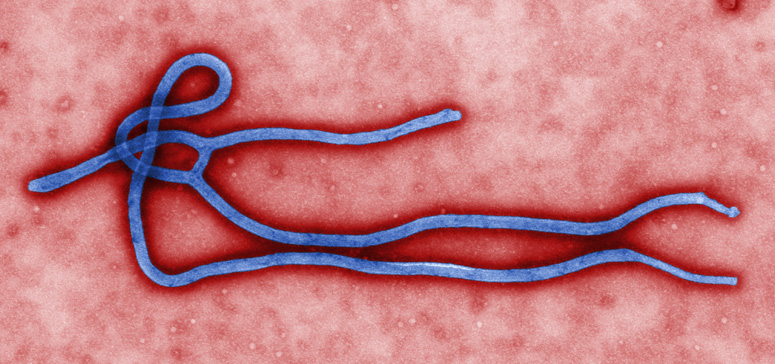 ebola